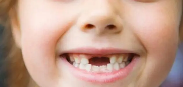 تفسير الاحلام سقوط الأسنان