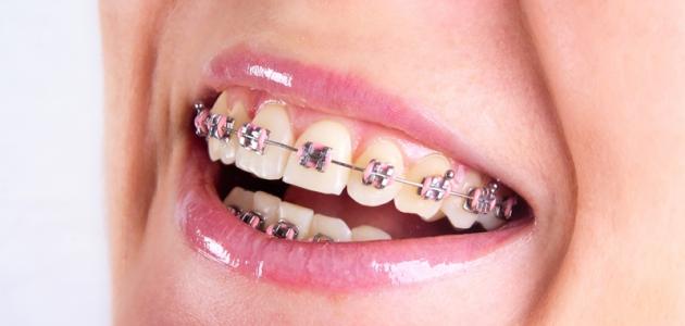 تفسير تصليح الأسنان في المنام للمتزوجة