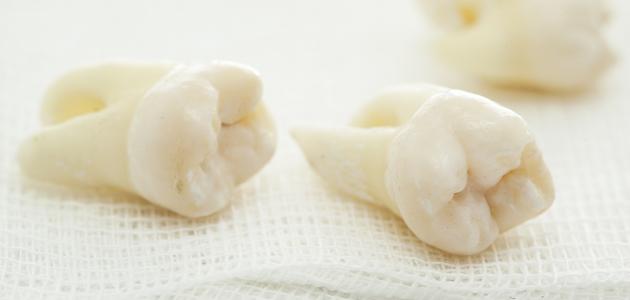 تفسير خلع الضرس في المنام للعزباء